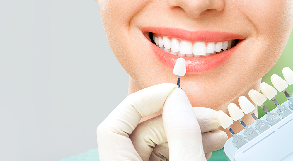 Dental İmplant